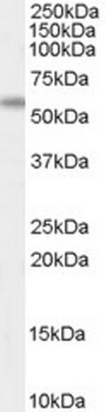 AIRE Antibody in Western Blot (WB)