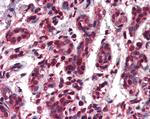 TCF3 Antibody in Immunohistochemistry (Paraffin) (IHC (P))