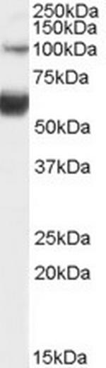 TCF2 Polyclonal Antibody