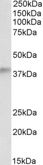ADH5 Polyclonal Antibody