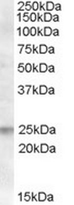 FAIM Antibody in Western Blot (WB)