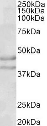 NPY2R Polyclonal Antibody