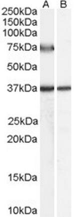 ACOX2 Polyclonal Antibody