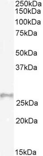 Gpx3 Antibody in Western Blot (WB)