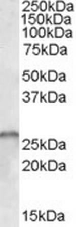 SMN1/SMN2 Polyclonal Antibody