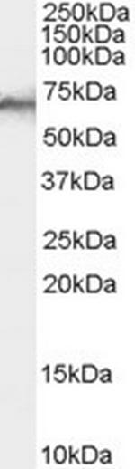 SHP-1 Antibody in Western Blot (WB)