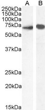 SHP-1 Antibody in Western Blot (WB)