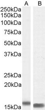 FABP2 Antibody in Western Blot (WB)