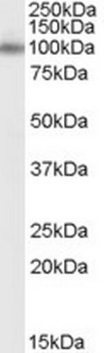 APBA1 Antibody in Western Blot (WB)