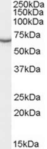 PCK1 Polyclonal Antibody