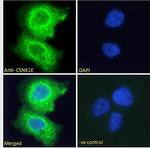 CK1 epsilon Antibody in Immunocytochemistry (ICC/IF)