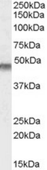 Kir6.2 (KCNJ11) Antibody in Western Blot (WB)