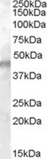 Kir6.2 (KCNJ11) Antibody in Western Blot (WB)
