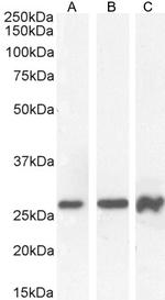 PAX6 Polyclonal Antibody