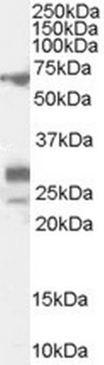 SALL4 Polyclonal Antibody