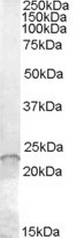 ASF1A Polyclonal Antibody