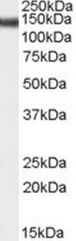 STAG2 Polyclonal Antibody