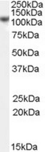 NCAPH Polyclonal Antibody