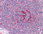 GABPB2 Antibody in Immunohistochemistry (Paraffin) (IHC (P))