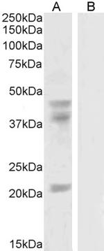 GABPB2 Antibody in Western Blot (WB)