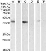 PTF1A Polyclonal Antibody