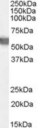 G6PD Antibody in Western Blot (WB)