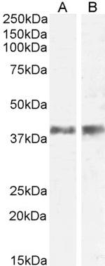 IL-12 p40 Polyclonal Antibody
