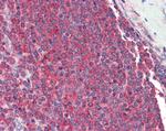 RPL8 Antibody in Immunohistochemistry (Paraffin) (IHC (P))