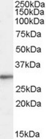 RPL8 Antibody in Western Blot (WB)