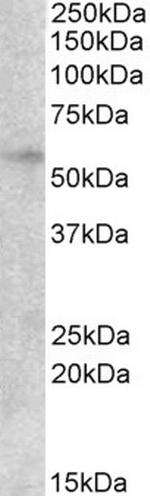 EGR2 Polyclonal Antibody