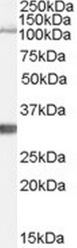 IDE Antibody in Western Blot (WB)