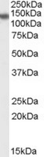 PHLPP2 Polyclonal Antibody