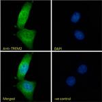 TREM2 Antibody in Immunocytochemistry (ICC/IF)