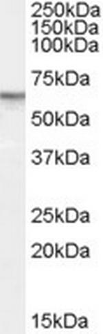 PDE11A Antibody in Western Blot (WB)