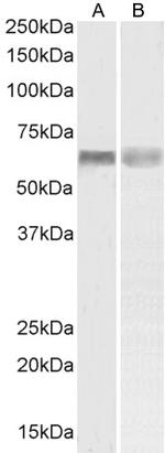 PINK1 Polyclonal Antibody