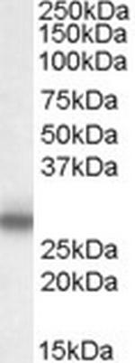 MPZ Polyclonal Antibody