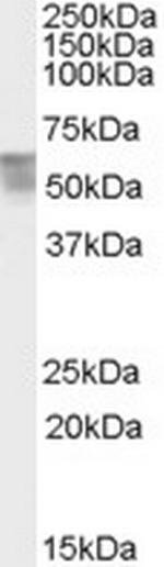 THRA Antibody in Western Blot (WB)