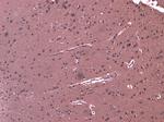 LGP2 Polyclonal Antibody