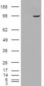 SMEK1 Antibody in Western Blot (WB)