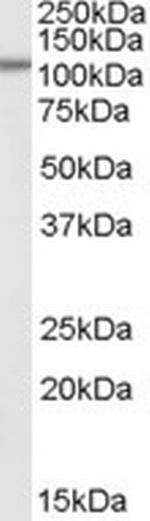 SMEK1 Polyclonal Antibody