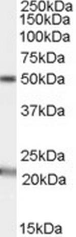 AGK Polyclonal Antibody