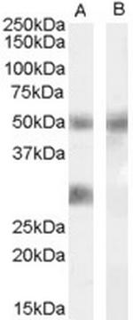 IGFBP3 Polyclonal Antibody