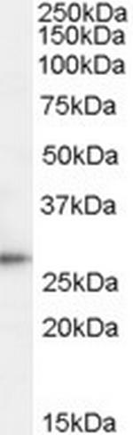 TPD52 Antibody in Western Blot (WB)
