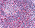 TPD52L2 Antibody in Immunohistochemistry (Paraffin) (IHC (P))