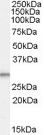 TPD52L2 Antibody in Western Blot (WB)