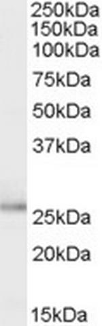 TPD52L1 Polyclonal Antibody