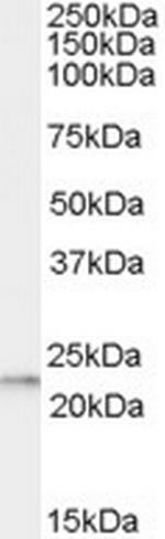 RPL17 Polyclonal Antibody