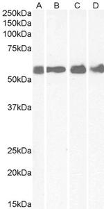 CRHR1 Polyclonal Antibody