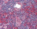 CADM4 Antibody in Immunohistochemistry (Paraffin) (IHC (P))