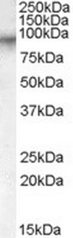 Factor XIII A Polyclonal Antibody